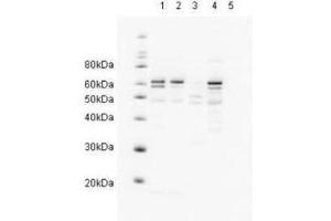 Western blot showing  Affinity Purified anti-HR23A antibody detects endogenous human HR23A. (RAD23A Antikörper  (AA 122-135))