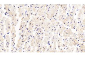 Detection of MYOM2 in Human Cardiac Muscle Tissue using Polyclonal Antibody to Myomesin 2 (MYOM2) (MYOM2 Antikörper  (AA 1130-1434))