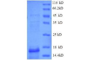 ESAT-6-Like Protein EsxB (AA 2-100), (full length) protein (His tag) (ESAT-6-Like Protein EsxB Protein (AA 2-100, full length) (His tag))