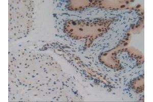 IHC-P analysis of Mouse Vas Deferens Tissue, with DAB staining. (IRF2 Antikörper  (AA 1-349))