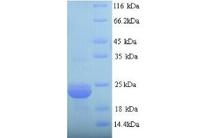 SDS-PAGE (SDS) image for YOAJ (AA 26-232) protein (ABIN5714286) (YOAJ (AA 26-232) Protein)