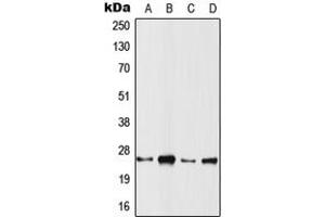Western blot analysis of RRAS2 expression in Jurkat (A), A431 (B), MCF7 (C), SP2/0 (D) whole cell lysates.