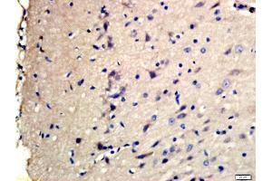 Formalin-fixed and paraffin embedded rat brain labeled with Rabbit Anti-TSC2(Ser1798) Polyclonal Antibody, Unconjugated (ABIN712121) at 1:200 followed by conjugation to the secondary antibody and DAB staining (Tuberin Antikörper  (pSer1798))