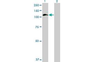 Western Blot analysis of HIP1 expression in transfected 293T cell line by HIP1 MaxPab polyclonal antibody. (HIP1 Antikörper  (AA 1-1037))