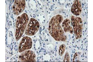 Immunohistochemical staining of paraffin-embedded Human Kidney tissue using anti-ACY1 mouse monoclonal antibody.