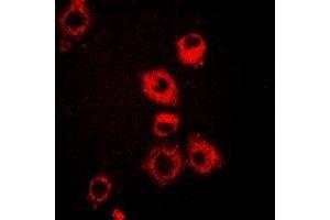 Immunofluorescent analysis of VAP-1 staining in A549 cells. (AOC3 Antikörper)