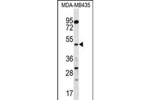 SNX4 Antibody (C-term) (ABIN656781 and ABIN2845999) western blot analysis in MDA-M cell line lysates (35 μg/lane). (Sorting Nexin 4 Antikörper  (C-Term))