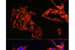 Immunofluorescence analysis of HeLa cells using PIK3CA Polyclonal Antibody at dilution of 1:100. (PIK3CA Antikörper)