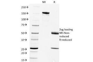 SDS-PAGE Analysis of Purified, BSA-Free Rabies Virus Antibody (clone Rab-50). (Rabies Virus Antikörper)