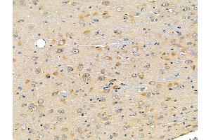 ABIN6260870 and ABIN6266837 at 1/100 staining Mouse brain tissue by IHC-P. (Claudin 7 Antikörper  (C-Term))
