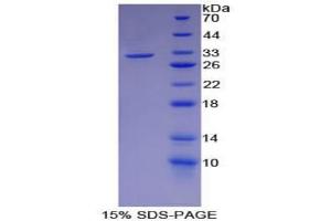 SDS-PAGE analysis of Mouse Smad6 Protein. (SMAD6 Protein)