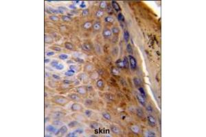 Formalin-fixed and paraffin-embedded human skin reacted with KRT10 Antibody , which was peroxidase-conjugated to the secondary antibody, followed by DAB staining. (Keratin 10 Antikörper  (AA 318-346))