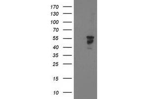 Western Blotting (WB) image for anti-Beclin 1, Autophagy Related (BECN1) antibody (ABIN1496867) (Beclin 1 Antikörper)
