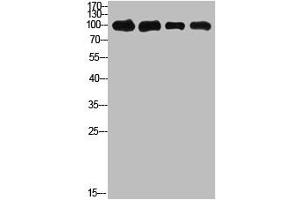 Western Blot analysis of 1,mouse-kidney 2,mouse-heart 3,3T3 4,Hela cells using primary antibody diluted at 1:500(4 °C overnight). (ACO2 Antikörper  (AA 421-470))