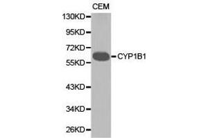Western Blotting (WB) image for anti-Cytochrome P450, Family 1, Subfamily B, Polypeptide 1 (CYP1B1) antibody (ABIN1872164) (CYP1B1 Antikörper)