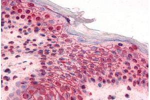 Human Skin (formalin-fixed, paraffin-embedded) stained with GLI2 antibody ABIN351530 at 5 ug/ml followed by biotinylated goat anti-rabbit IgG secondary antibody ABIN481713, alkaline phosphatase-streptavidin and chromogen. (GLI2 Antikörper  (AA 46-60))