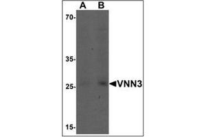 Western blot analysis of VNN3 in human brain tissue lysate with VNN3 Antibody  at (A) 0.