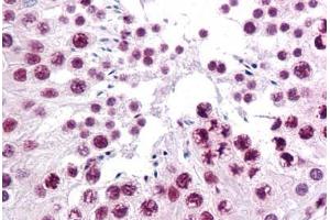 Human Testis: Formalin-Fixed, Paraffin-Embedded (FFPE) (SIRT1 Antikörper  (AA 456-555))