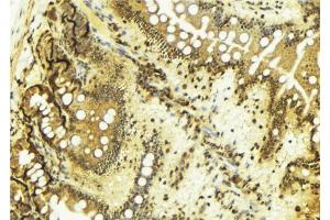 ABIN6269045 at 1/100 staining Mouse colon tissue by IHC-P. (CHEK1 Antikörper  (Internal Region))