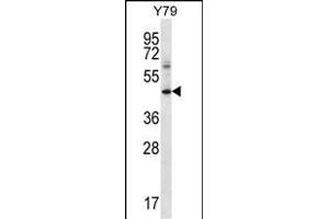 IFNGR1 Antibody (C-term) (ABIN656579 and ABIN2845842) western blot analysis in Y79 cell line lysates (35 μg/lane). (IFNGR1 Antikörper  (C-Term))