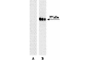 Western blot analysis of Btk (pY551) in human Burkitt’s lymphoma. (Btk and Itk (pTyr551) Antikörper)
