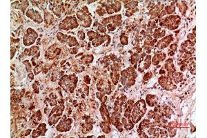 Immunohistochemistry (IHC) image for anti-Heparanase (HPSE) (Internal Region) antibody (ABIN6282531)