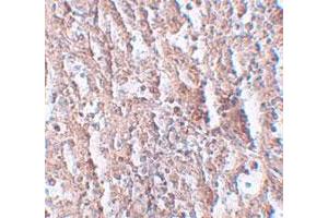 Immunohistochemical staining of human spleen cells with SLC39A5 polyclonal antibody  at 2. (SLC39A5 Antikörper  (Internal Region))