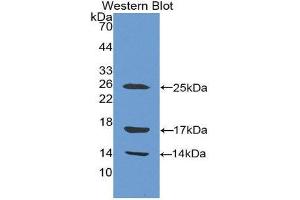 Western Blotting (WB) image for anti-Cathelicidin Antimicrobial Peptide (CAMP) (AA 31-170) antibody (ABIN1175684) (Cathelicidin Antikörper  (AA 31-170))