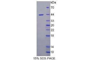 SDS-PAGE analysis of Mouse UQCRB Protein.