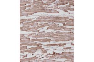 Immunohistochemistry (Paraffin-embedded Sections) (IHC (p)) image for anti-Receptor Tyrosine Kinase-Like Orphan Receptor 1 (ROR1) antibody (ABIN392043)