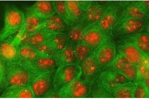 IF analysis of PSE/SPDEF using anti-PSE/SPDEF antibody (ABIN7601954) and anti-Tubulin Alpha antibody (ABIN7600339).