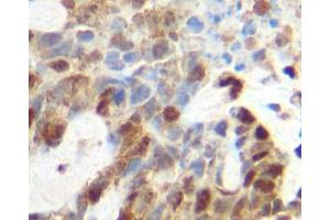 Image no. 2 for anti-Tumor Necrosis Factor alpha (TNF alpha) antibody (ABIN465605) (TNF alpha Antikörper)