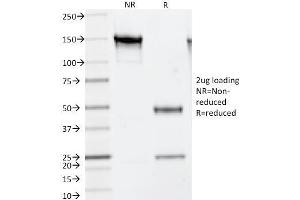 SDS-PAGE Analysis Purified Thymidylate Synthase Mouse Monoclonal Antibody (TS106). (TYMS Antikörper)