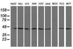 Image no. 2 for anti-serpin Peptidase Inhibitor, Clade B (Ovalbumin), Member 13 (SERPINB13) antibody (ABIN1500878) (SERPINB13 Antikörper)