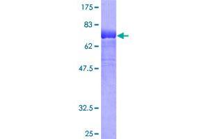 Image no. 1 for Kringle Containing Transmembrane Protein 2 (KREMEN2) (AA 1-420) protein (GST tag) (ABIN1308941)