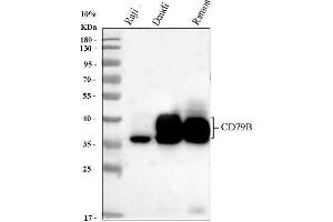 Western blot analysis of CD79b using anti-CD79b antibody (ABIN3043398). (CD79b Antikörper  (AA 29-229))