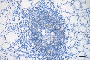 anti-PDZ and LIM Domain 1 (PDLIM1) antibody