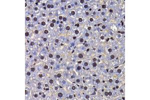 Immunohistochemistry of paraffin-embedded mouse liver using FIP1L1 antibody at dilution of 1:100 (x400 lens). (FIP1L1 Antikörper)