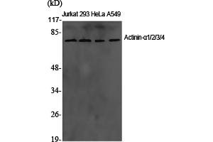 Western Blotting (WB) image for anti-Actinin, alpha 1/2/3/4 (ACTN1/ACTN2/ACTN3/ACTN4) antibody (ABIN5960682) (ACTN1/2/3/4 Antikörper)