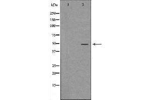 Western blot analysis of Hela whole cell lysates, using RBBP4 Antibody. (Retinoblastoma Binding Protein 4 Antikörper  (C-Term))