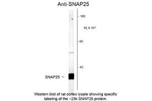 Image no. 1 for anti-Synaptosomal-Associated Protein, 25kDa (SNAP25) antibody (ABIN956767) (SNAP25 Antikörper)
