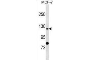 Western Blotting (WB) image for anti-Solute Carrier Family 4, Sodium Bicarbonate Cotransporter, Member 9 (SLC4A9) antibody (ABIN2999782) (SLC4A9 Antikörper)