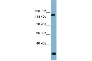 WB Suggested Anti-EPRS  Antibody Titration: 0.