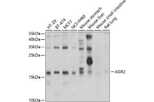 Western blot analysis of extracts of various cell lines, using  antibody (ABIN6131176, ABIN6136646, ABIN6136647 and ABIN6222857) at 1:1000 dilution. (AGR2 Antikörper  (AA 21-175))