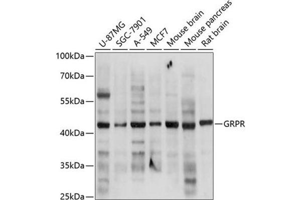 GRPR Antikörper  (AA 235-384)