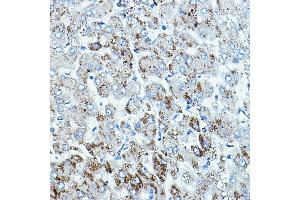 Immunohistochemistry of paraffin-embedded human liver using B-Raf Rabbit pAb (ABIN7265818) at dilution of 1:100 (40x lens). (BRAF Antikörper  (AA 350-449))