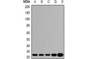 Western blot analysis of ATP5O expression in A549 (A), SKOV3 (B), mouse liver (C), mouse lung (D), rat heart (E) whole cell lysates. (ATP5O Antikörper)