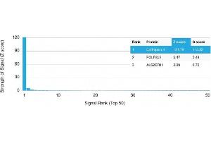 Analysis of Protein Array containing more than 19,000 full-length human proteins using Cathepsin K Mouse Monoclonal Antibody (CTSK/2793) Z- and S- Score: The Z-score represents the strength of a signal that a monoclonal antibody (MAb) (in combination with a fluorescently-tagged anti-IgG secondary antibody) produces when binding to a particular protein on the HuProtTM array.