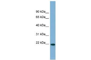 WB Suggested Anti-FNDC4 Antibody Titration:  0. (FNDC4 Antikörper  (Middle Region))
