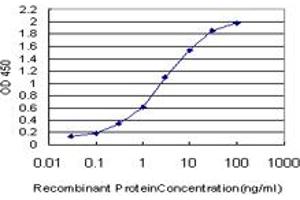 Detection limit for recombinant GST tagged SRF is approximately 0. (SRF Antikörper  (AA 406-508))
